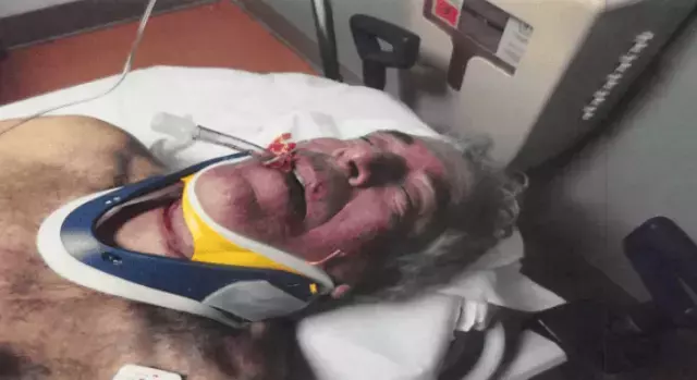 EPSTEIN’İN ÖLÜMÜNDE YENİ PERDE: CEZAEVİNDEN ÇEKİLEN FOTOĞRAFLAR TARTIŞMAYI YENİDEN BAŞLATTI