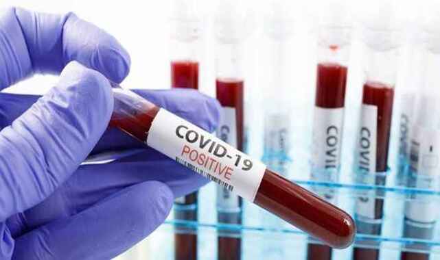 Koronavirüs cezalarının iadesi için başvuru formu yayımlandı;