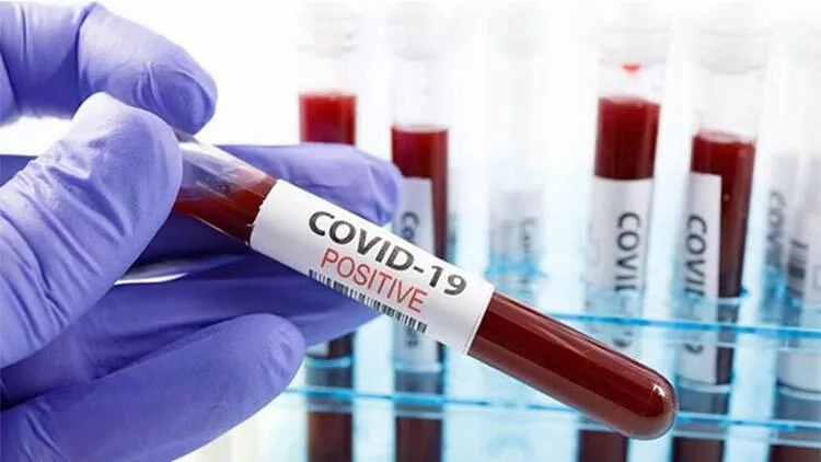 Haftalık koronavirüs tablosu açıklandı!;