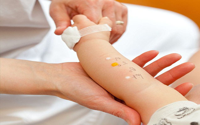 Urfa’da çocuk alerji uzmanı yok: Hastalar çevre illere gitmek zorunda;