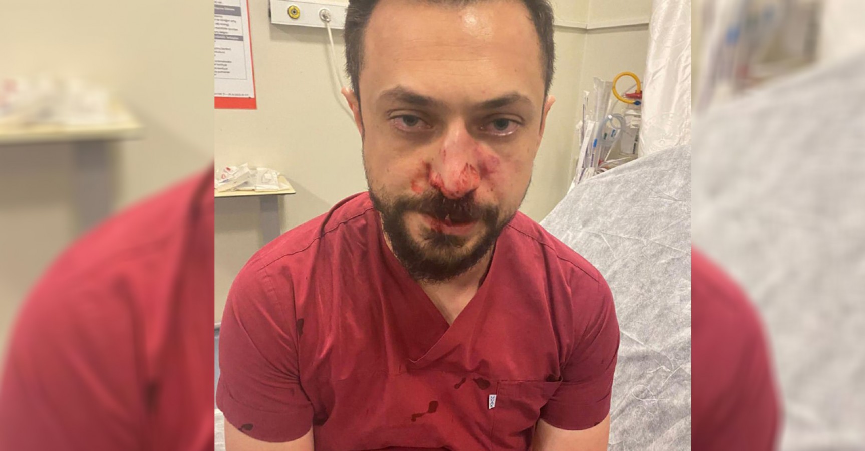 Urfa'da aynı doktora ikinci kez saldırı! Bu kez burnu kırıldı...;