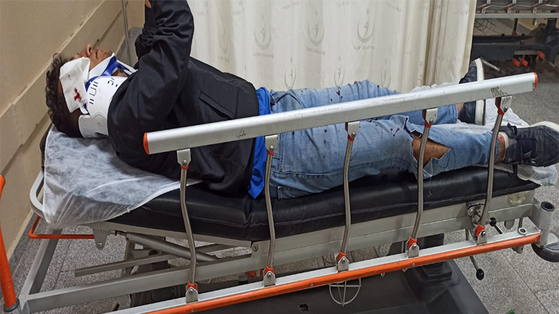 Urfa’da motosiklet sürücüsü hastanelik oldu;